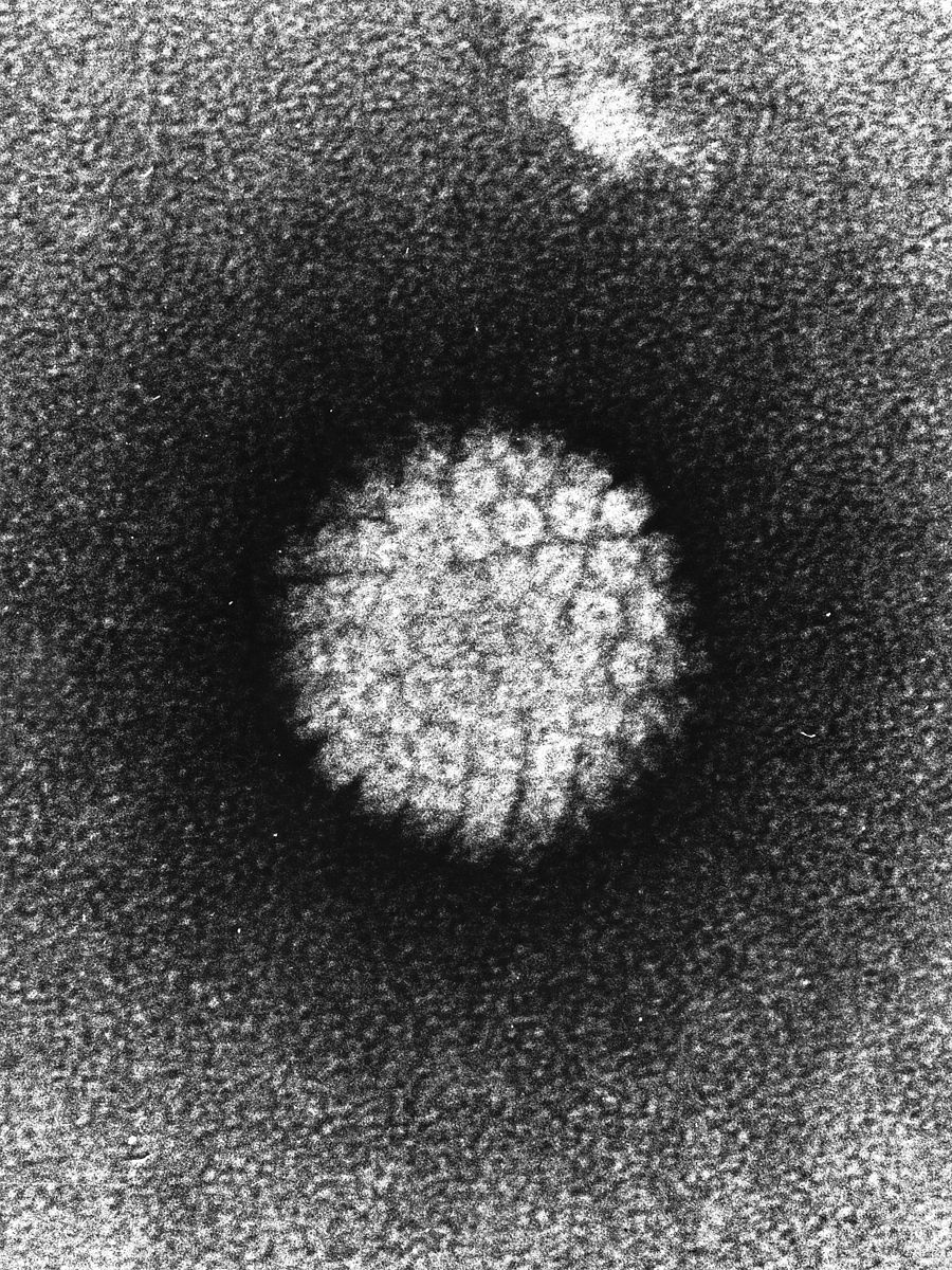 Image of the HPV virus under scanning microscopy